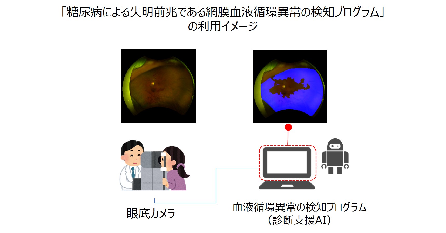 自治医科大学発ベンチャーDeepEyeVision株式会社が、NEDO「研究開発型スタートアップ支援事業/シード期の研究開発型スタートアップに対する事業化支援」に採択