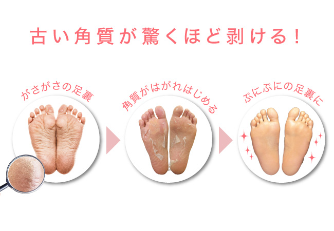 足裏の古い角質が除去されぷにぷにの素足に