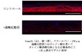皮脂の酸化が頭皮のかゆみの一因となるメカニズムを確認
