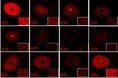 ケラチン分布パターンがクセ・直毛の違いに関係性があることを発見