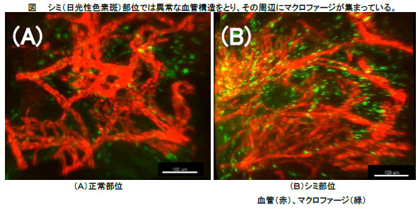 資生堂 シミの肌内部における血管構造異常の3d可視化に成功 株式会社資生堂のプレスリリース