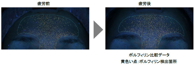 疲れが肌に及ぼす影響についての新発見 疲れにより 酸化ダメージのもととなる ポルフィリン が増加 株式会社資生堂のプレスリリース