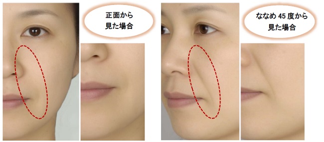 正面顔とななめ45度顔では印象が違う 比較したときの見た目 年齢差がわかる ななめ45度チェック サイトを年7月日 月 より公開スタート 株式会社資生堂のプレスリリース