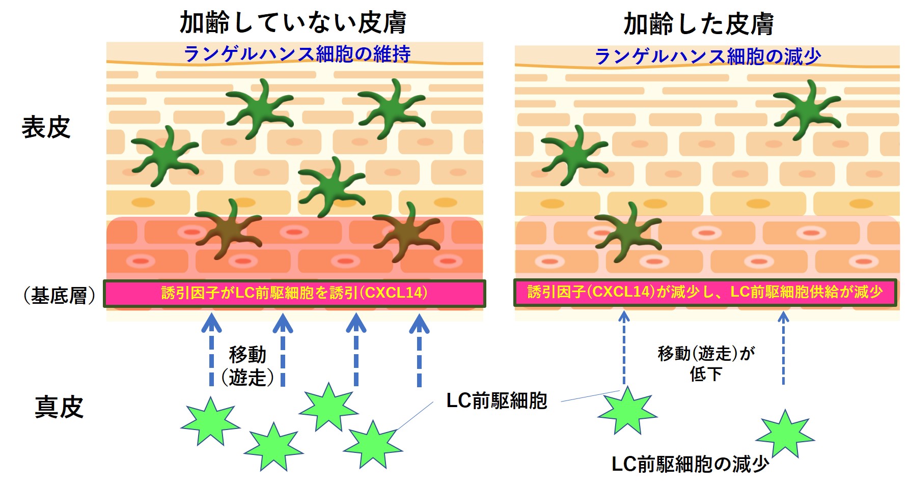 ランゲルハンス