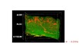 資生堂、独自の皮ふ透明化技術を発展させ免疫細胞の3D可視化に成功、皮ふの免疫機能解明を加速 ~免疫研究のさらなる発展に寄与、肌本来の美しさの実現へ~