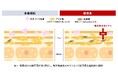 資生堂、菌叢研究を通じて敏感肌には表皮ブドウ球菌の生育を阻害する特殊なアクネ菌が多いことを発見 ~特殊なアクネ菌を選択的に抑制する効果を微生物由来エキスに発見~