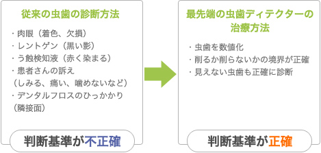 虫歯ディテクターを使用して虫歯の度合いを数値で表示