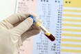 CTC検査「CTC Scancer」ヒロクリニックで10月開始!がんの超早期発見を可能に