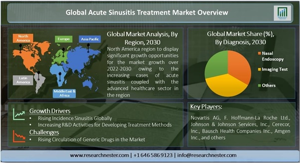 急性副鼻腔炎治療市場ー診断別 治療別 生理食塩水点鼻薬 コルチコステロイド薬 経口充血除去薬療法 副鼻腔拡張装置 薬物療法 および手術 エンドユーザー別 世界の需要分析と機会の見通し2030年 Kenneth Researchのプレスリリース