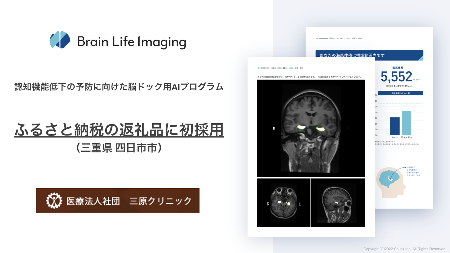 ふるさと納税返礼品に初採用。脳ドック用AIプログラム「Brain Life Imaging® 」が三重県四日市市 三原クリニックの脳年齢ドックとして導入