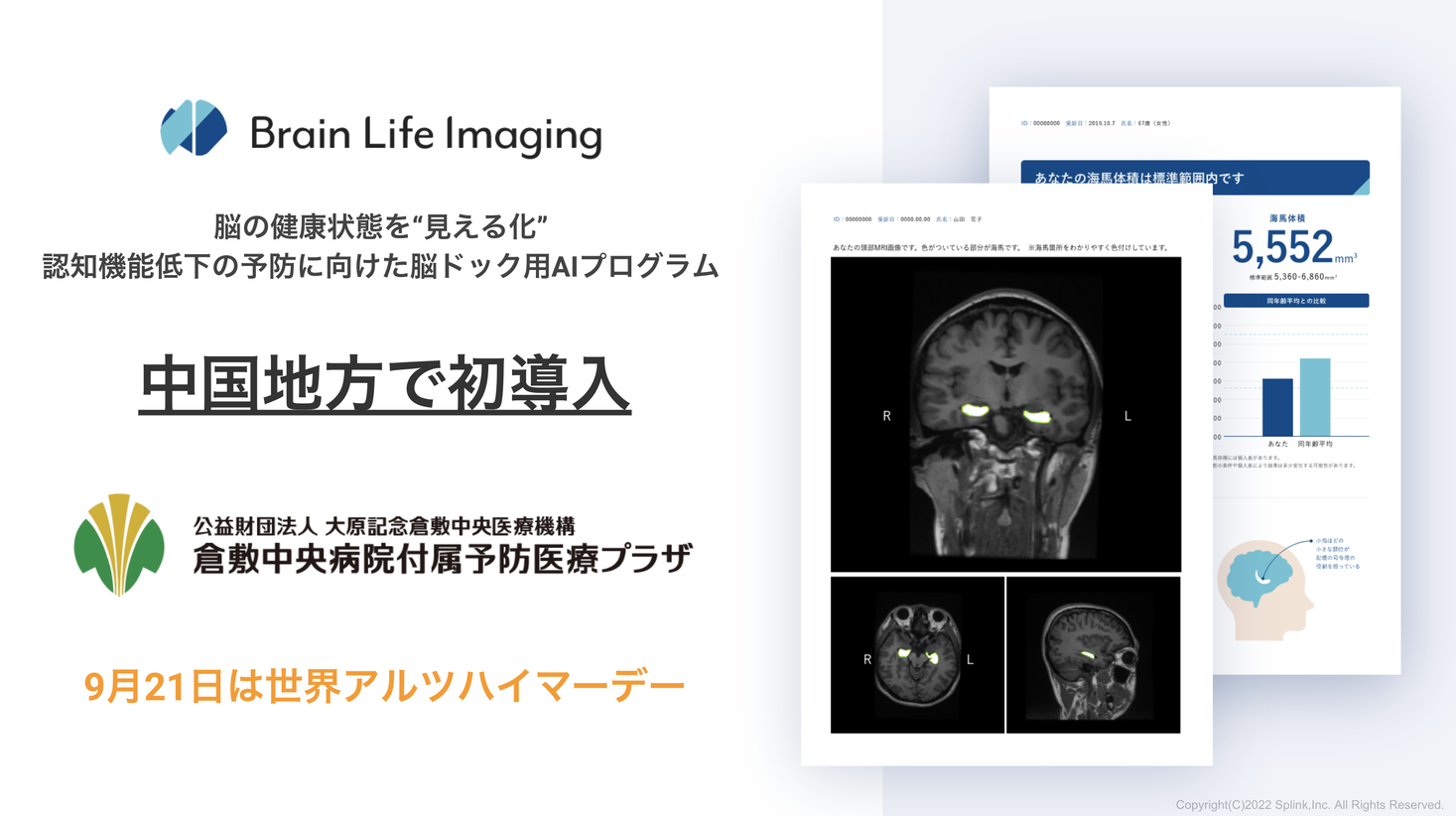 【中国地方で初導入】脳の健康状態を“見える化”。認知機能低下の予防に向けた脳ドック用AIプログラム「Brain Life Imaging® 」が倉敷中央病院付属予防医療プラザで導入