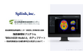 東京都健康長寿医療センター研究所と共同研究の成果による脳画像解析プログラム「BRAINEER Model A」のアップデート