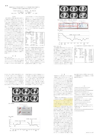 SARS-CoV-2のPCR検査が陰性であったが現病歴と胸部CT検査からCOVID-19が疑われ迅速抗体検査で診断に至った例(黄色での着色は弊社によるもの) SARS-CoV-2のPCR検査が陰性であったが現病歴と胸部CT検査からCOVID-19が疑われ迅速抗体検査で診断に至った例(黄色での着色は弊社によるもの)