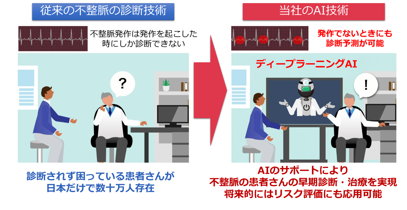 世界初 不整脈の発症予測が可能なai 人工知能 の治験を株式会社カルディオインテリジェンスが実施へ 株式会社カルディオインテリジェンスのプレスリリース