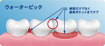 89％の歯科医が推奨する口腔洗浄器※1、世界シェアNo.1※2の「Waterpik