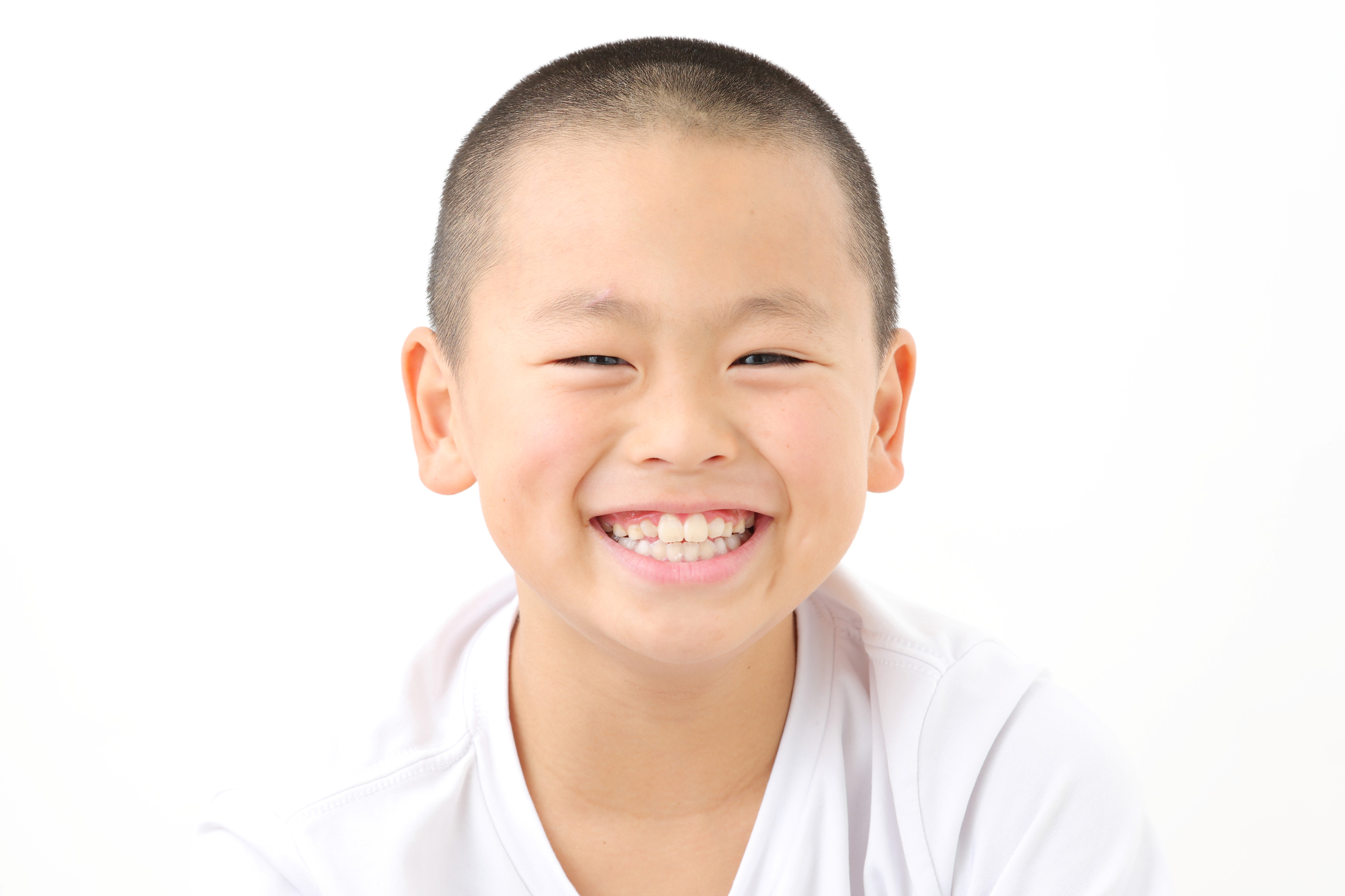 男の子脱毛 を開始 メンズガーデン 名古屋 栄エリアの個室脱毛サロン Micler株式会社のプレスリリース