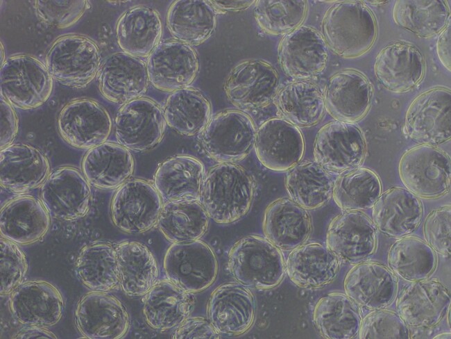 マイクロキャリア上のヒト間葉系幹細胞の顕微鏡像（提供：大阪大学工学研究科 紀ノ岡研究室）