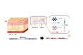 皮膚バリア機能が低下傾向にある敏感肌とセラミドの実態研究