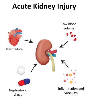 Acute Kidney Injury Treatment Market