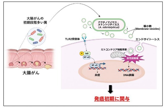 腸内細菌による大腸がんの新たな発生機序を解明！