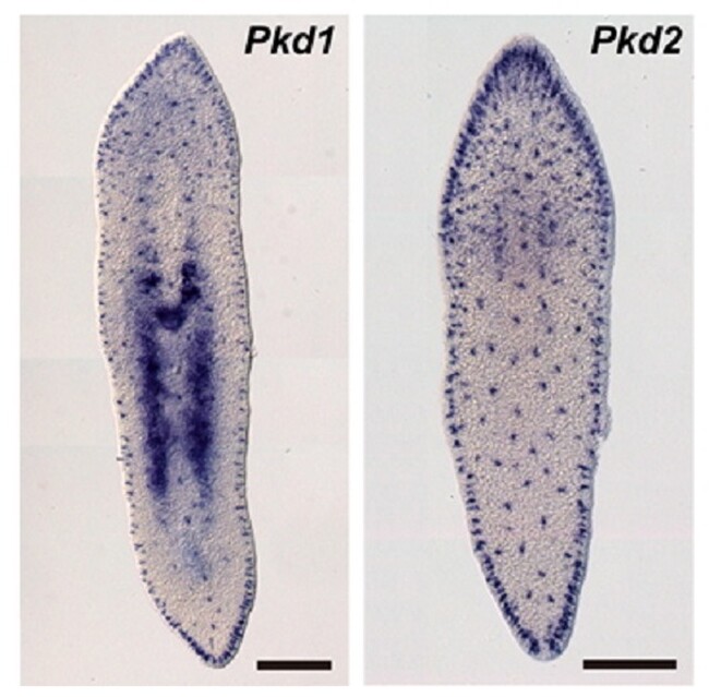 TRPPに分類されるPkd1とPkd2遺伝子の発現