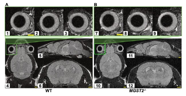 野生型マウス（A）とMGST2欠損ホモ接合体マウス（B）の眼球（上段図）と脳全体（下段図）のMRI画像。岡山大学薬学部に設置されている小動物用MRI装置で撮影