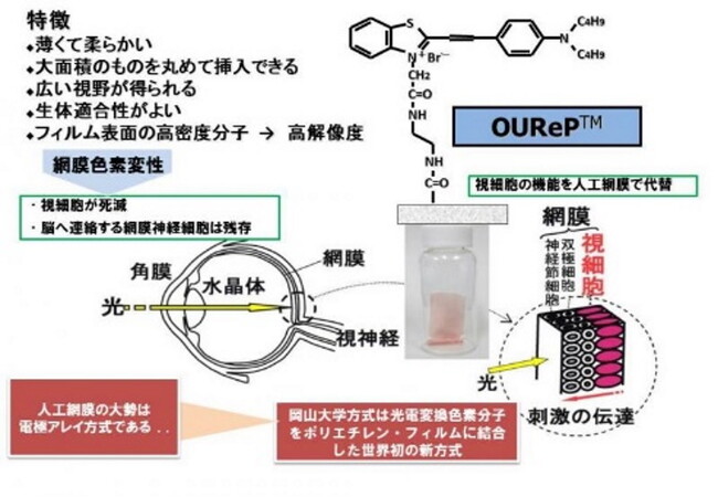 光電変換色素分子を素子として使う光電変換色素薄膜型人工網膜（OUReP）