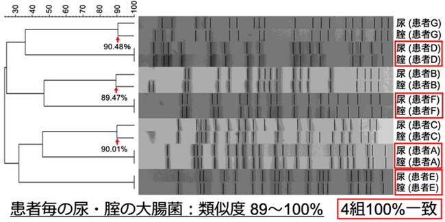 パルスフィールド電気泳動によるデンドログラム