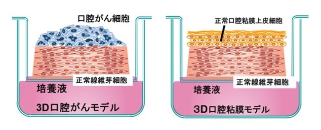 3D口腔がんモデルと3D口腔粘膜モデルの模式図