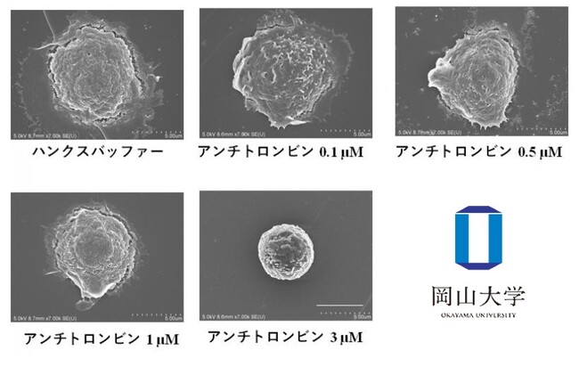 ヒト好中球のアンチトロンビンによる形態変化（走査電子顕微鏡写真）