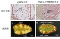 無花粉スギ（MS2タイプ）の候補遺伝子を同定－花粉を作らない原因の解明に前進－〔森林研究・整備機構森林総合研究所, 新潟大学,東京大学, 基礎生物学研究所, 新潟県森林研究所, 岡山大学〕