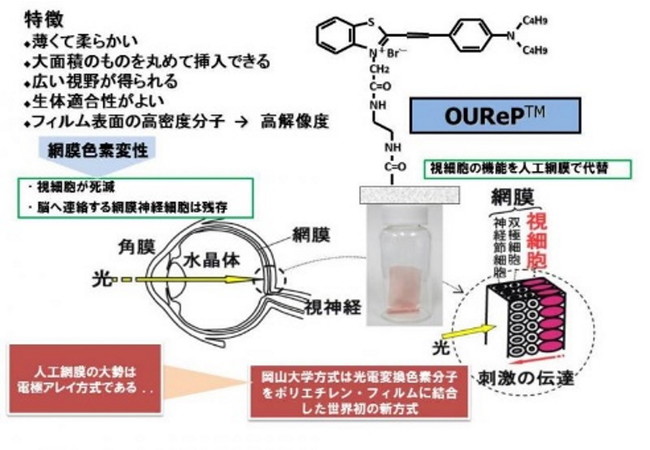 光電変換色素分子を素子として使う色素結合薄膜型人工網膜（OUReP™）