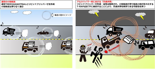 アルツハイマー病(AD)における小胞輸送障害の概念図 アルツハイマー病(AD)における小胞輸送障害の概念図