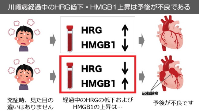 図2. 川崎病経過中のHRGとHMGB1の推移