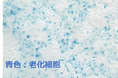 世界初!キリンと東京大学が、ヒトiPS細胞由来小腸オルガノイドを用いた老化抑制素材の有効性確認に成功
