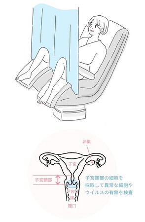 子宮頸部細胞診検査 子宮頸部細胞診検査