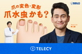 テレシー、佐藤製薬の爪水虫の疾患啓発を目的としたテレビCMの制作・放映を担当