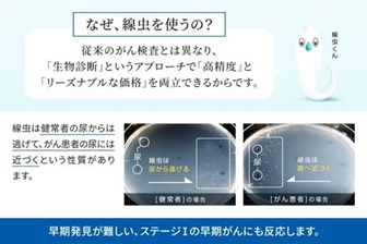 ふるなび限定】尿一滴でがんを早期発見！線虫がん検査”N-NOSE（エヌノーズ）”を掲載開始！ 投稿日時： 2022/12/01 14:47[PR  TIMES] - みんかぶ