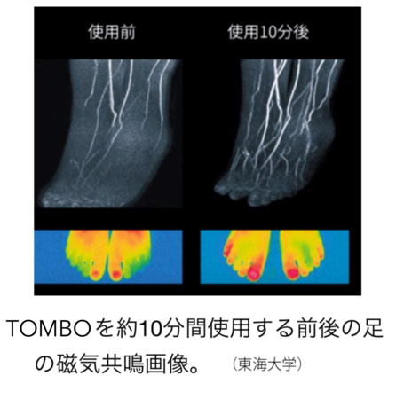 Tombo をわずか10分使用した後の足のMRIのビフォーアフター