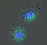 黄色ブドウ球菌を貪食したマクロファージ　青の蛍光は細胞の核。緑の蛍光が黄色ブドウ球菌（貪食されると緑色の蛍光を発する成分が結合している）