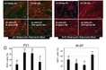 LPSがヒト皮膚線維芽細胞の老化を抑制・若返りを促進する効果について論文発表