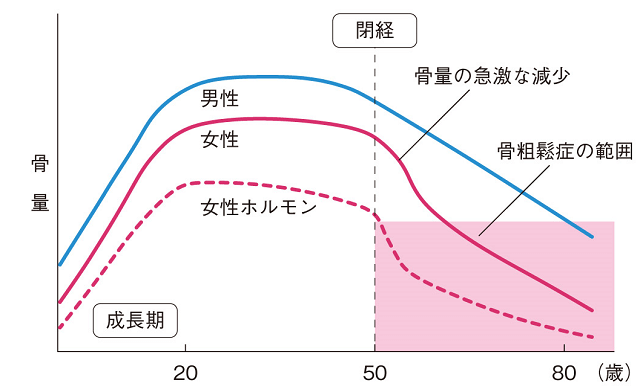出典:公益財団法人骨粗鬆症財団 出典:公益財団法人骨粗鬆症財団