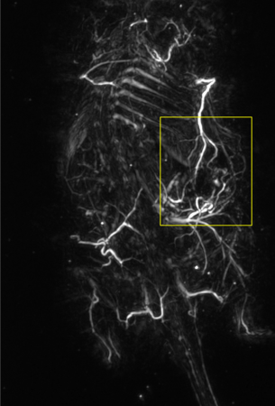 マウス背部に乳癌をブロック状にして埋め込んだ腫瘍の光超音波像