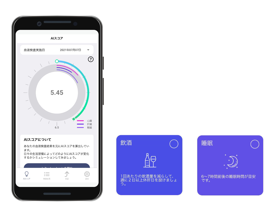 糖尿病AIアプリ「dAlbet」でSBI証券と連携　生活改善策表示し、予防取り組めるよう促す