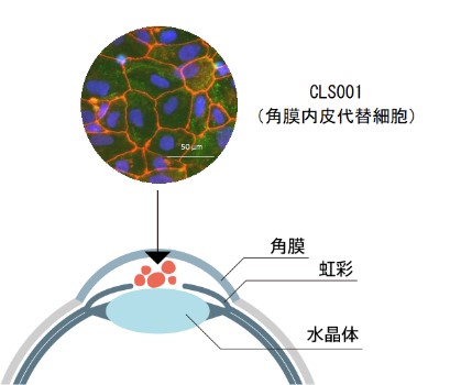 角膜内皮代替細胞移植のイメージ