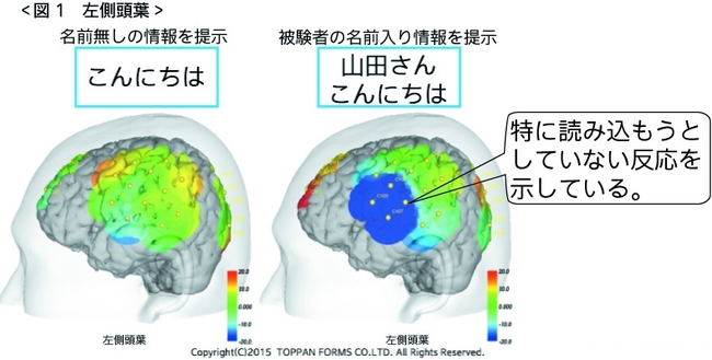 図1　左側頭葉の反応