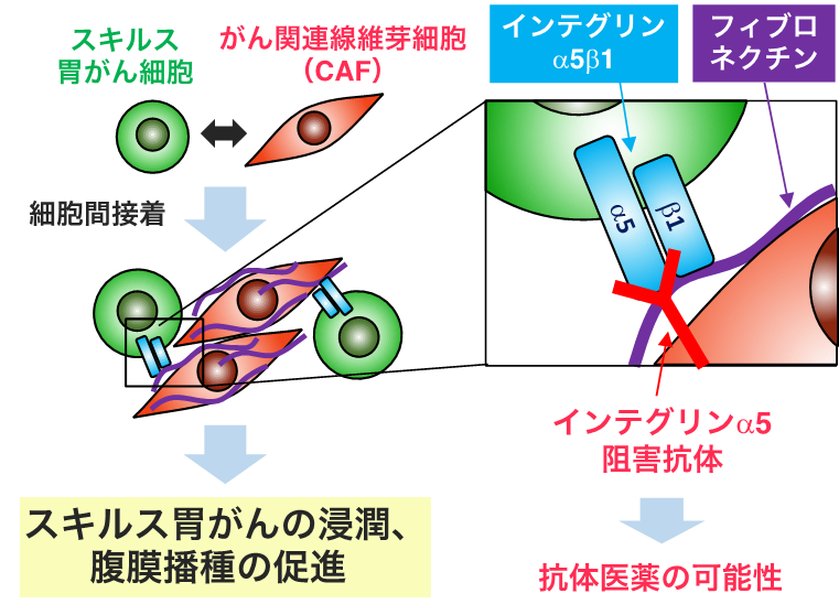 スキルス胃がんの新たな治療標的分子を同定｜公益財団法人 佐々木研究所のプレスリリース