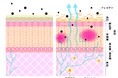 アトピー性皮膚炎治療に新たな知見! 世界最小*1「ナノサイズ微細水粒子AIR(アイル)」がアトピー性皮膚炎の症状を緩和する可能性