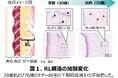 皮下深部の「Retaining Ligament(RL)」がたるみと関連