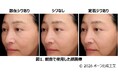 「散在シワ」と「定着ジワ」では肌やその人の印象に及ぼす影響が異なることを発見